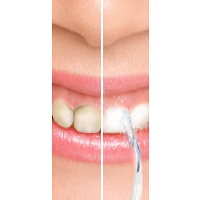 HomeLife Ústna sprcha WATER GENIUS modrá