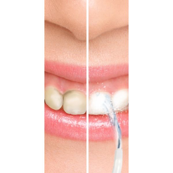 HomeLife Ústna sprcha WATER GENIUS modrá